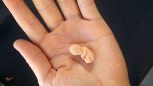 Mom Rejects Abortion After Seeing Fetal Model of 8-Week-Old Unborn Baby