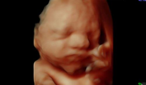 Poll Shows Americans Want Their Employers to Fund Pro-Life Options Not Abortions