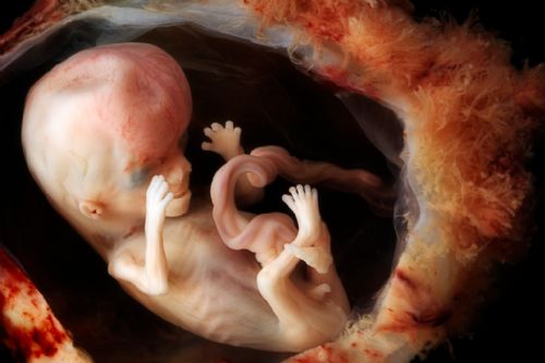 Abortion Activists Hate Ultrasound Pictures Because They Prove Unborn Babies are Human Beings