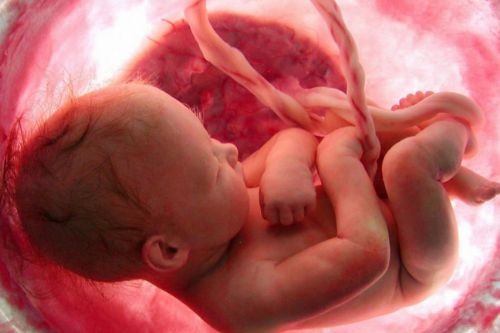 Quit Using Euphemisms and Tell the Truth: Abortions Kill Babies