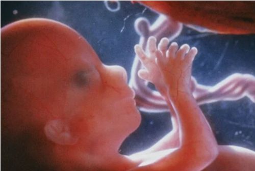 Trump Admin Expected to Block Funding of Research With Aborted Baby Parts