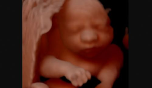84% of Abortion Pill Shipments are Going to Pro-Life States, We Must Stop This