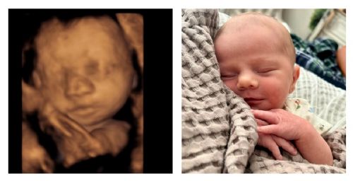 Florida Heartbeat Law is Saving 300 Babies From Abortion Every Month