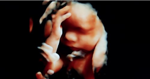 Florida Bill Would Confirm Human Life Begins at Conception